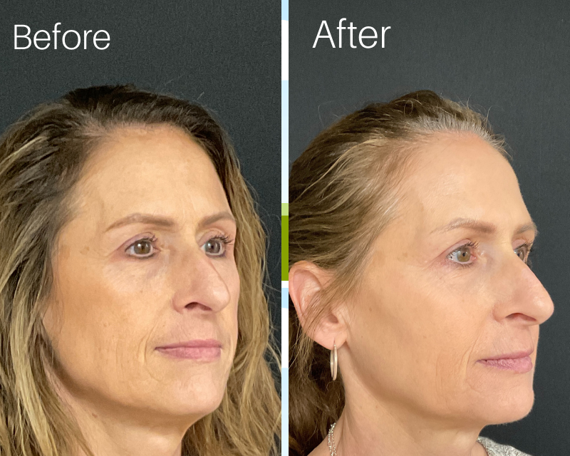 Cata-Kor - NAD+ Anti-Aging Supplement (Limited Time Offer)